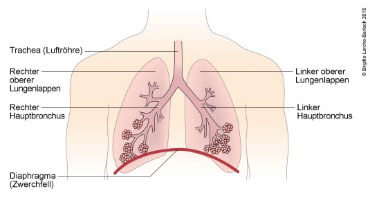 Bronchialbaum Bronchialbaum