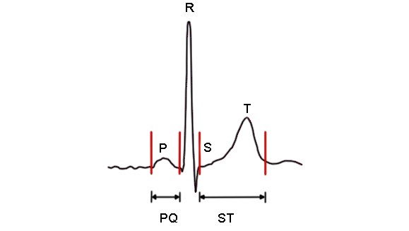 Bezeichnung der einzelnen EKG-Abschnitte