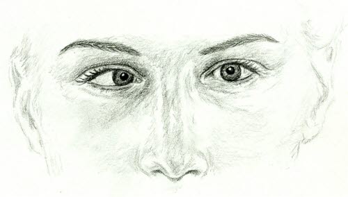 Strabismus convergens (Esotropie, Innenschielen) des rechten Auges