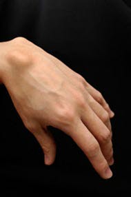 Ganglion